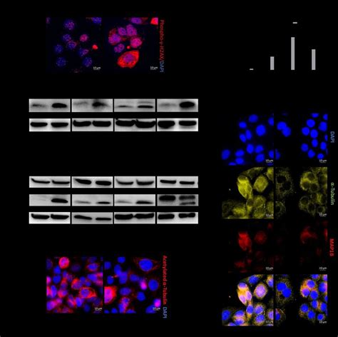 Ldhc Regulates Dna Damage Accumulation And Microtubule Network