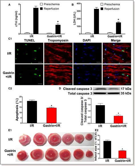 Figure From Gastrin Protects Against Myocardial Ischemia Reperfusion