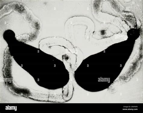 Effect Of Cobalt 60 Gamma Rays On The Biology Of The Eye Gnat