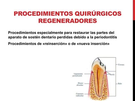 Cicatrizacion Y Regeneracion Tisular Guiada Ppt