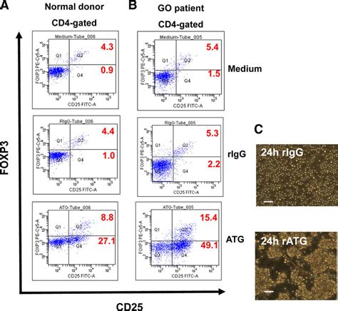 Expression Of Cd Cd Foxp Treg Cell Markers On Pbmcs Of A Go