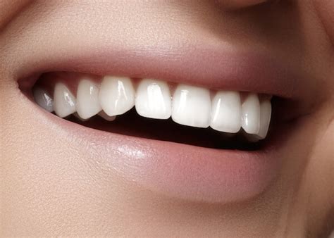 The 5 Types of Teeth