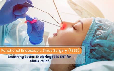 Revolutionizing Sinus Care Best Hospitals Fess Functional Endoscopic