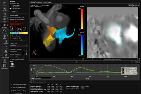 D Flow Pie Medical Imaging