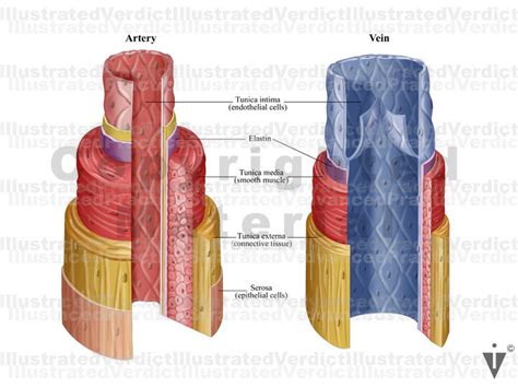 Stock Lower Limb Vasculature Illustrated Verdict