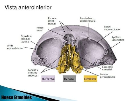 Frontal Y Etmoides Frontal