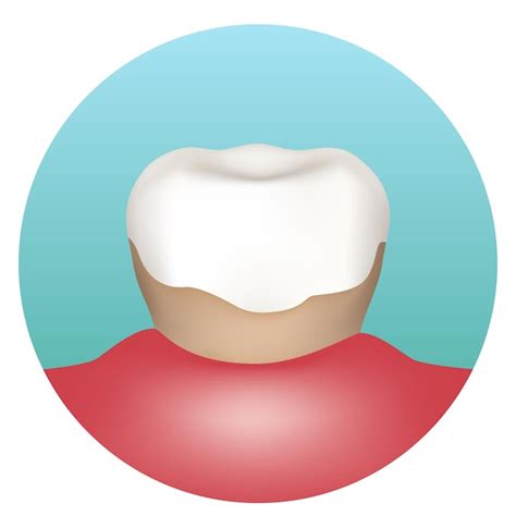 Premium Vector Tartar Tooth With Tartar Vector Illustration