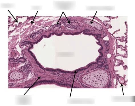 Bronchus Histology Diagram | Quizlet