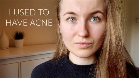 My Simple Morning And Evening Skincare Routines Acne Prone Combo Skin