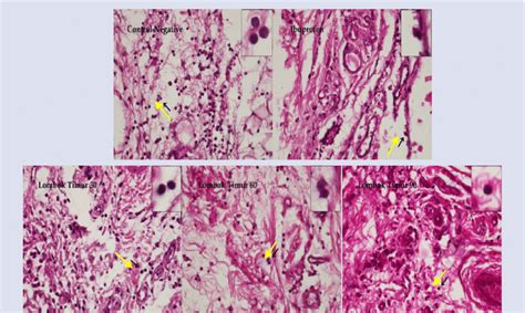 Photomicrographs Of The Histopathological Analysis Of Paw Tissue From