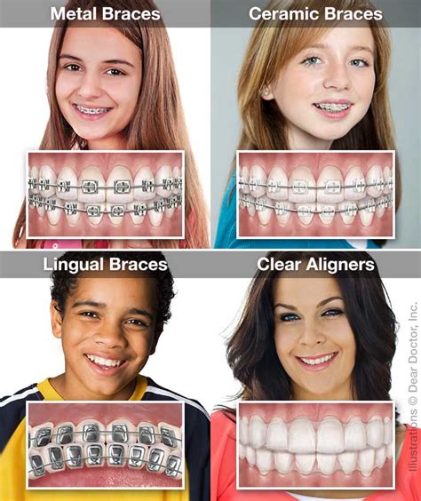 Orthodontics Overview Doctors Morris And Taylor Ltd Elizabeth City North Carolina