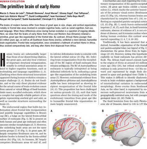 Topographical Relationships Between Neurocranial And Brain Structures