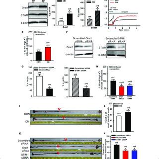 Orai1 And STIM1 Protein Expression Levels Store Operated Ca 2 Entry