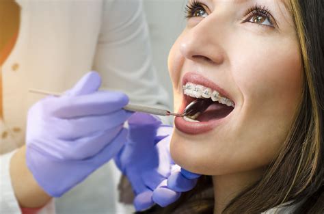 Ceramic Braces Periodontal Gum Disease