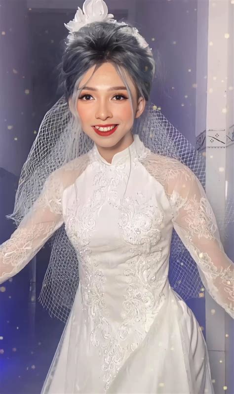 Hot Tiktoker Võ Thành Ý tiết lộ dao kéo diện mạo sau phẫu thuật gây bất ngờ