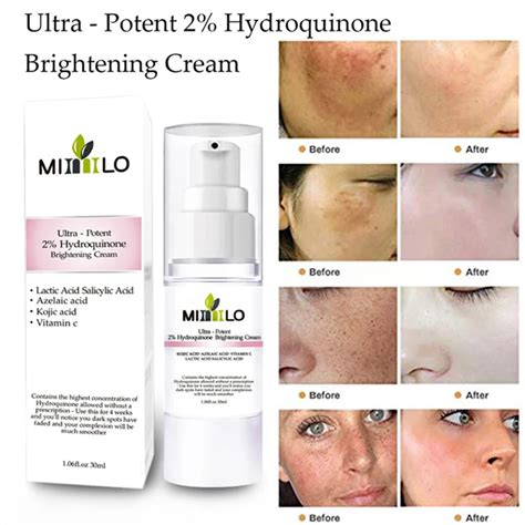 Ultra Potent 2 Hydroquinone Brightening Cream Propylene Glycol Kojic Acid Fade Dark Spots Face