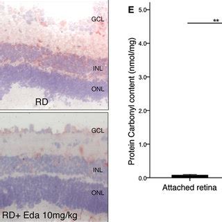 Quantification Of Oxidative Retinal Damage In Retina With HNE