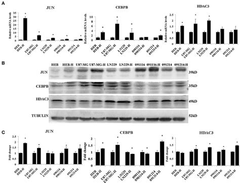 Molecular Mechanisms Of Drug Resistant Phenotype In Hypoxic Gbm