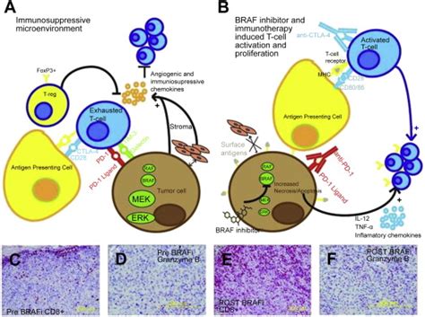 Introduction to the Role of the Immune System in Melanoma | Oncohema Key