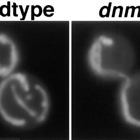 Mitochondrial Morphology In Wild Type Dnm1 And Dnm1Δ Mutant Strains