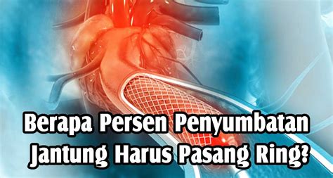 Berapa Persen Penyumbatan Jantung Harus Pasang Ring Nutra Jaya Prima