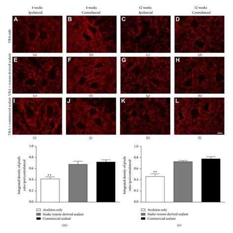 Immunohistochemical Analysis Of The Spinal Cord Ventral Horn Stained