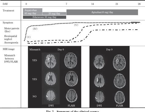 Figure From A Case Of Internal Carotid Artery Occlusion Resulted In