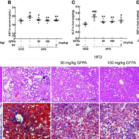 Gfpa Alleviated Hepatic Steatosis In Mice With Dio In Hfd Fed Mice