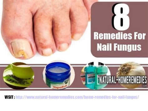 8 Home Remedies For Nail Fungus