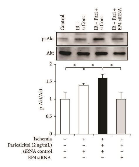 Paricalcitol Induced EP4 Mediated Phosphorylation Of Akt And CREB In