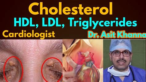 High Cholesterol Hdl Ldl Triglycerides Facts And Way To Reduce It