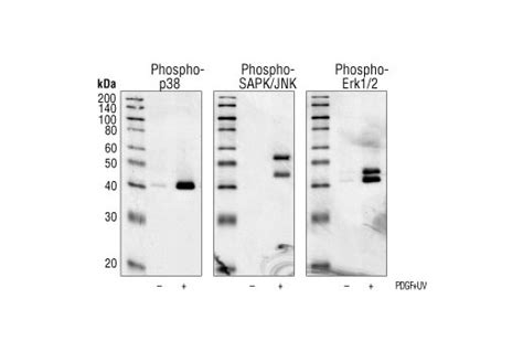 Phospho P38 Mapk Thr180tyr182 3d7 Rabbit Mab Cell Signaling