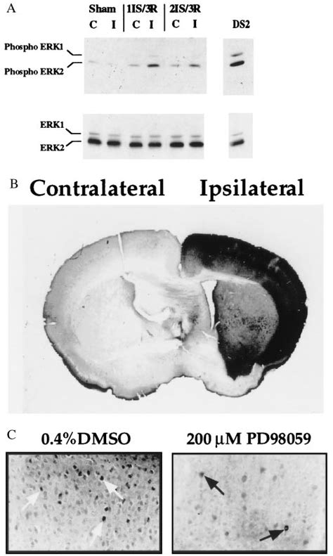 A Increase In Erk12 Phosphorylation After Ischemia And Reperfusion