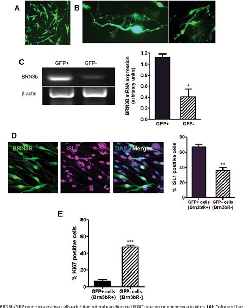 Figure 3 from Human Müller Glia with Stem Cell Characteristics