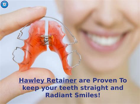 Hawley Retainers Orthodontic Experts By Orthodontic Experts Of Algonquin Issuu