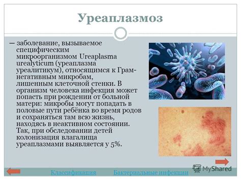 Презентация на тему: "Венерические заболевания. Заболевания ...