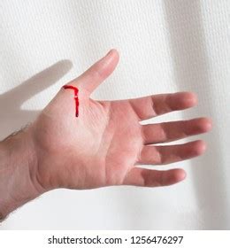 Manos Cortadas Con Sangre Foto De Stock Shutterstock