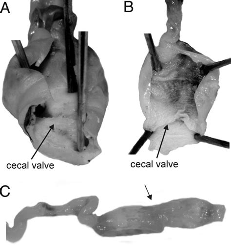 photographs illustrating  cecal valves   male   female