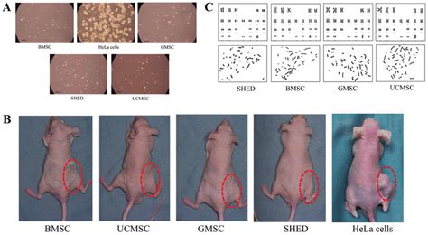 Tumorigenicity Of Mscs A Soft Agar Colony Assay For Mscs And Hela Download Scientific