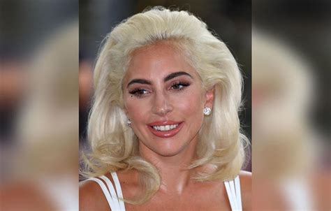 Lady Gagas Plastic Surgery Makeover Exposed By Top Docs