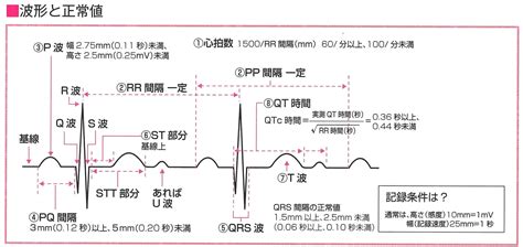 なんでみんな心電図が苦手なの？ 5 看護に役立つ【ナース専科プラス】