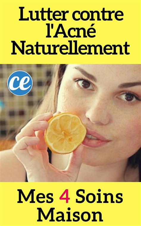 Comment Lutter contre l Acné Naturellement Mes 4 Soins Maison