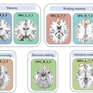 Figure Brain Areas With The Most Discriminative Ability Between Groups