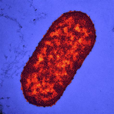 Klebsiella Pneumoniae Bacterium Photograph By Dr Klaus Boller Pixels