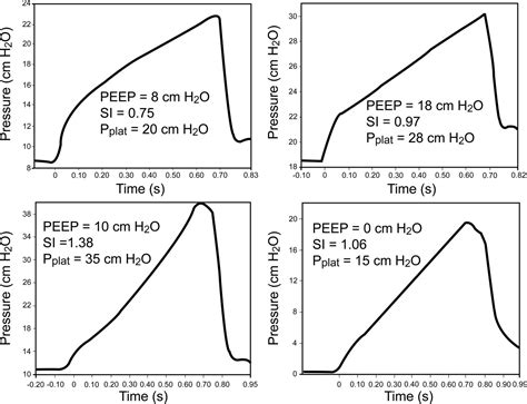 Recruitment Maneuvers And PEEP Titration Respiratory Care