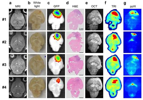 Condensed Matter Free Full Text THz Pulsed Imaging In Biomedical