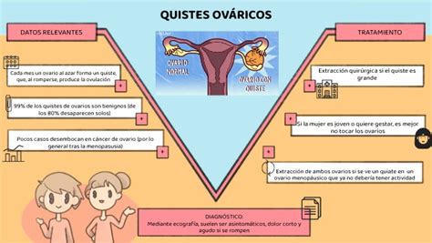 QUISTES OVÁRICOS