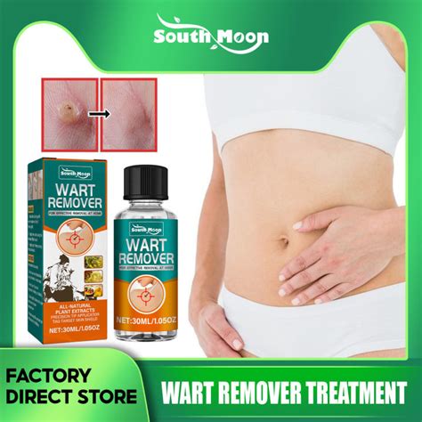 South Moon Wart Remover Liquid Skin Tag Removal Creams Removal