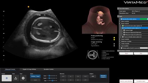 Virtamed Gynos™ Transabdominal Obstetric Ultrasound Simulator Youtube