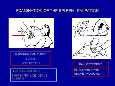 Physical Examination Of The Spleen Examination Of The